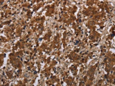 FGF20 Antibody