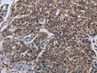 FGF20 Antibody