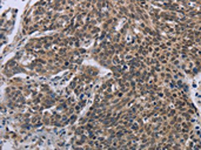 FGF20 antibody