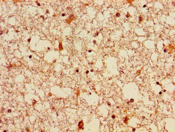 FGF22 Antibody