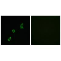 FGF23 Antibody