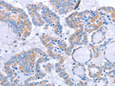 FGF4 antibody