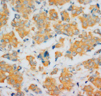 Anti-Fibroblast growth factor 4 FGF4 Antibody