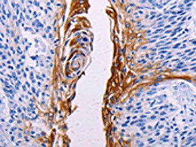 FGF7 Antibody