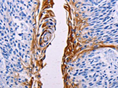 FGF7 antibody