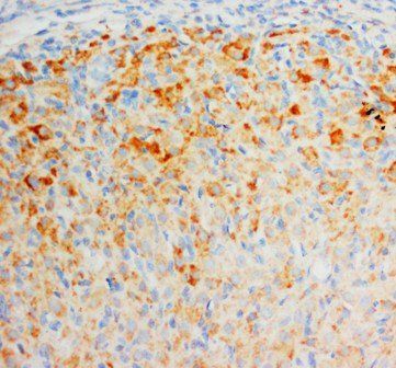 Anti-Fibroblast growth factor 8 FGF8 Antibody