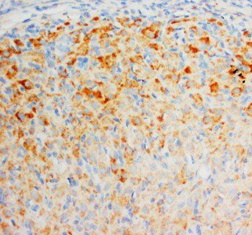 Fibroblast growth factor 8 FGF8 Antibody