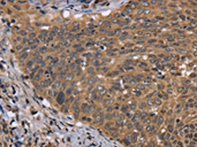 FGFR1OP Antibody