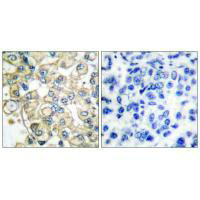 FGFR1OP Antibody