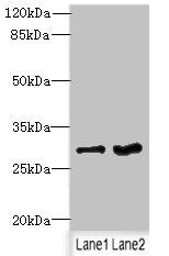 FGFR1OP2 Antibody