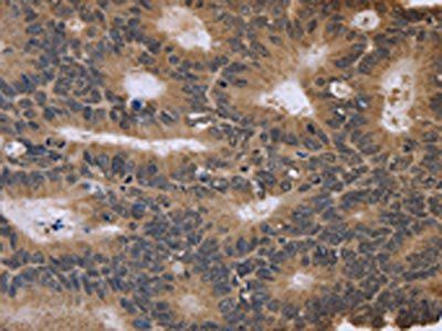 FGFR1OP2 Antibody