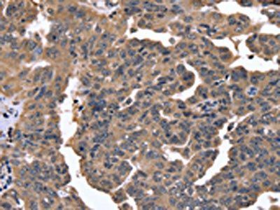 FGFR1OP2 Antibody