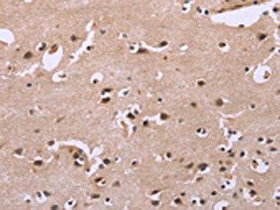 FGFR2 Antibody