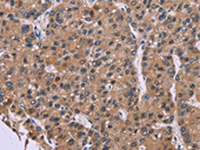 FGFR2 Antibody
