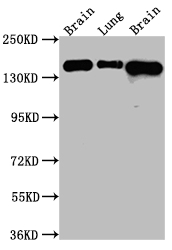 FGFR2 Recombinant Monoclonal Antibody