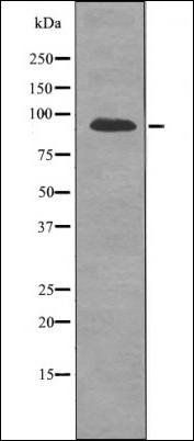 FGFR2 (Phospho-Ser782) antibody