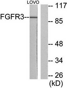 FGFR3 antibody
