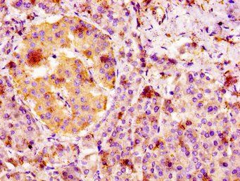 FGFR4 Antibody