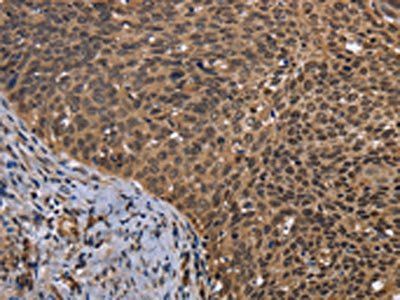 FGFRL1 Antibody