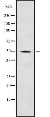 Fgl2 antibody