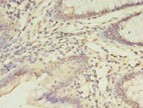 FGL2 Antibody