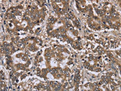 FGL2 Antibody