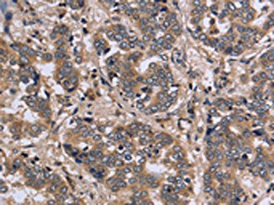 FGL2 Antibody
