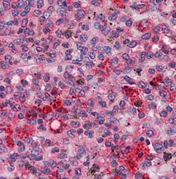 FGR Antibody