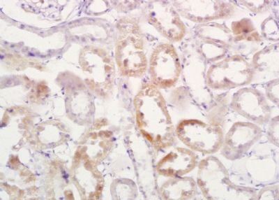 FHIT Rabbit Polyclonal Antibody