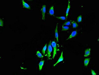 FHL1 antibody