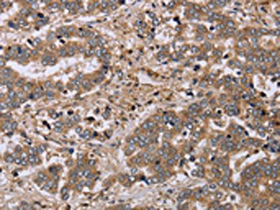 FHL1 Antibody