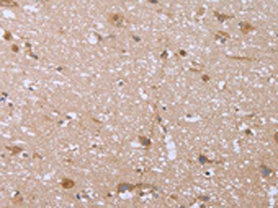 FHL2 Antibody