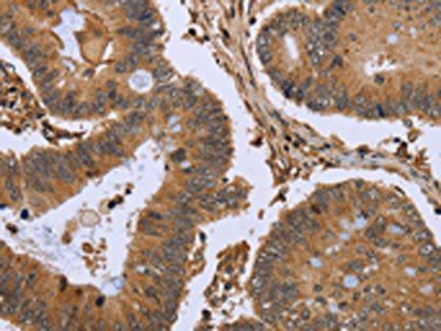 FHL2 Antibody