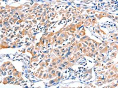 FHL5 antibody