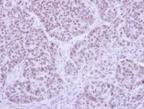 FHL5 Rabbit Polyclonal Antibody