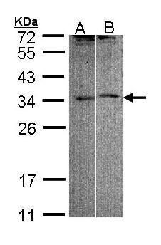 FHL5 Rabbit Polyclonal Antibody