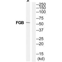 Fibrinogen antibody