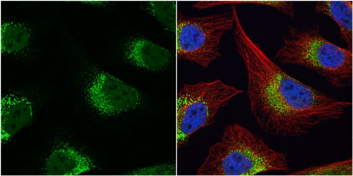 Fibrinogen gamma antibody