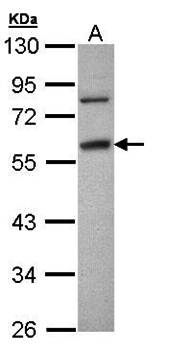 Fibrinogen gamma antibody
