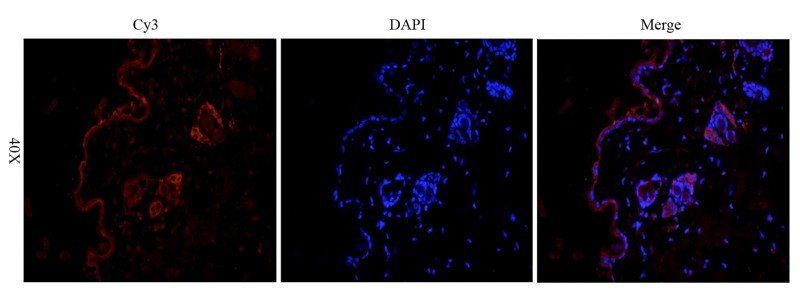 Fibrinopeptide B antibody