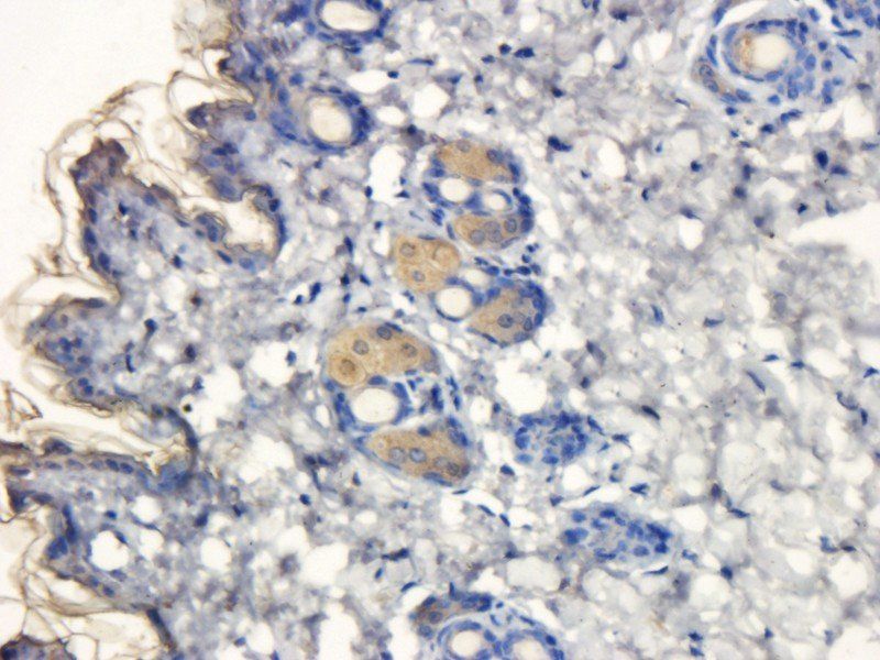 Fibrinopeptide B Rabbit Polyclonal Antibody