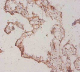 Fibroblast growth factor 1 antibody