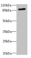 Fibroblast growth factor R 3 antibody