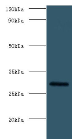 Fibroblast growth factor 23 antibody