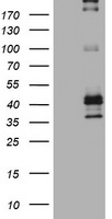 Fibronectin (FN1) antibody