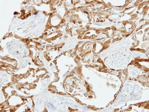 Fibulin 2 antibody
