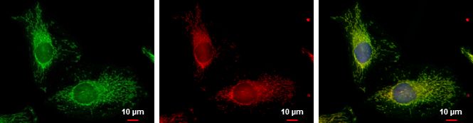 fission, mitochondrial 1 Antibody