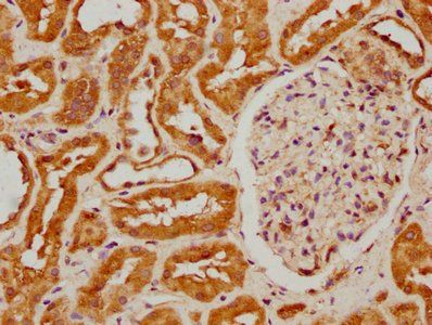 FIZ1 Antibody