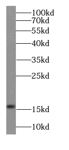 FKBP2 antibody
