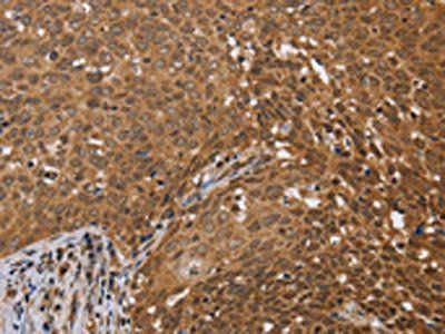 FKBP8 Antibody